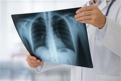 X-Ray