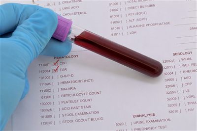 Laboratory Tests