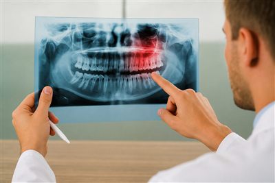 Dental Panoramic X-Ray